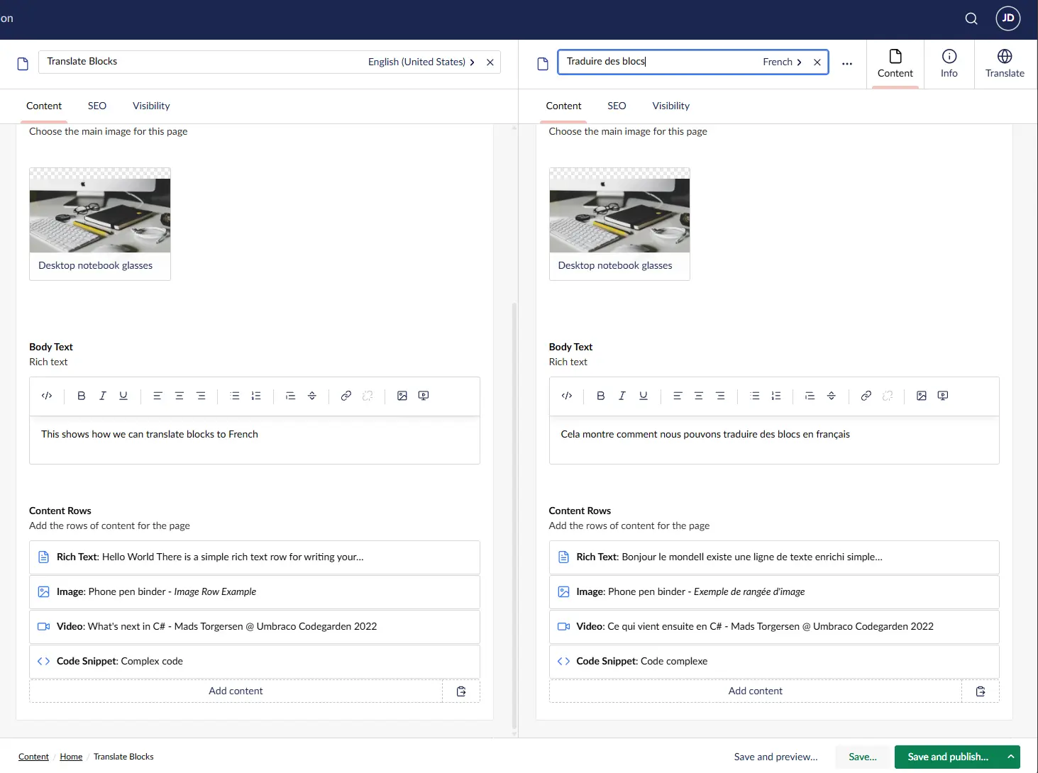 English and French Block List content displayed side by side in Umbraco